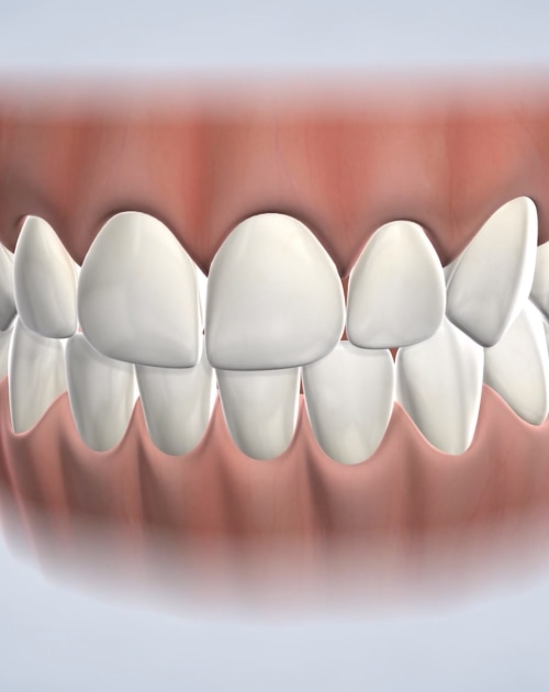 Icon Dental Treatment Cost